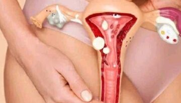Do A Woman’s Private Part Get Looser After Having Too Much Sex.