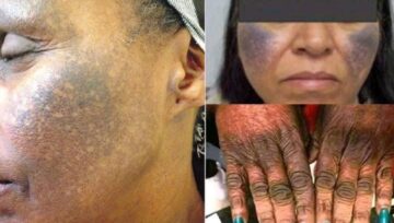 Be Warned; If You Are Using One Of These Lotions, Stop Immediately