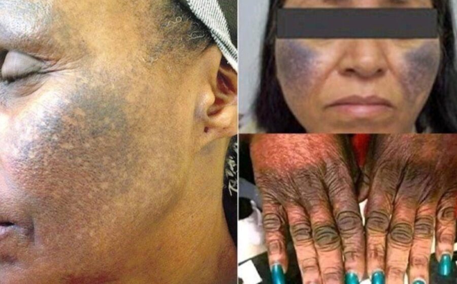 Be Warned; If You Are Using One Of These Lotions, Stop Immediately