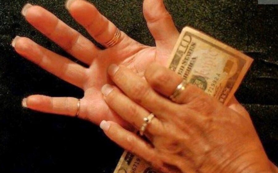 Itchy Palms Does Not Call For Money; Here Is What It Means About Your Health